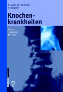 Knochenkrankheiten: Klinik Diagnose Therapie