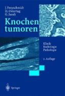 Knochentumoren Mit Kiefertumoren: Klinik - Radiologie - Pathologie