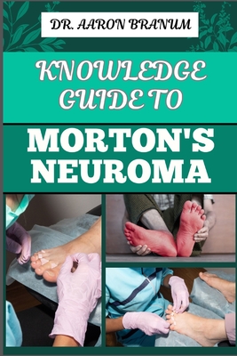 Knowledge Guide to Morton's Neuroma: Essential Manual To Symptoms, Diagnosis, Treatment, And Pain Relief For Foot Health And Nerve Pain Management - Branum, Aaron, Dr.