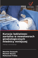 Kuracja l d wiowo-aortalna w nowotworach ginekologicznych miednicy mniejszej