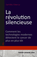 La r?volution silencieuse: Comment les technologies modernes d?tectent le cancer de plus en plus t?t