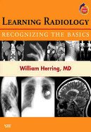 Learning Radiology: Recognizing the Basics