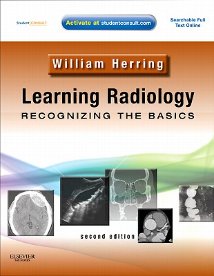 Learning Radiology: Recognizing the Basics - Herring, William, MD, Facr
