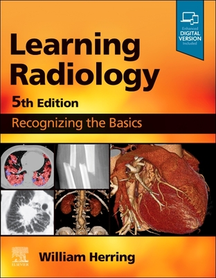 Learning Radiology: Recognizing the Basics - Herring, William, MD, Facr