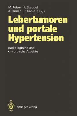 Lebertumoren Und Portale Hypertension: Radiologische Und Chirurgische Aspekte - Reiser, Maximilian (Editor), and Steudel, Andreas (Editor), and Hirner, Andreas (Editor)