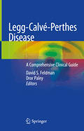 Legg-Calv-Perthes Disease: A Comprehensive Clinical Guide