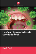 Les?es pigmentadas da cavidade oral