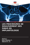 Les Proc?dures de Soul?vement Des Sinus En Implantologie