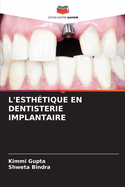 L'Esth?tique En Dentisterie Implantaire