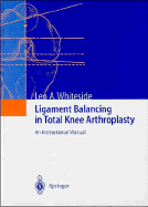 Ligament Balancing in Total Knee Arthroplasty: An Instructional Manual