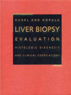 Liver Biopsy Evaluation: Histologic Diagnosis with Clinical Correlations
