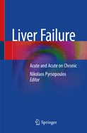 Liver Failure: Acute  and Acute on Chronic