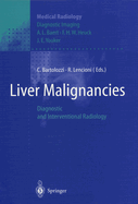 Liver Malignancies: Diagnostic and Interventional Radiology