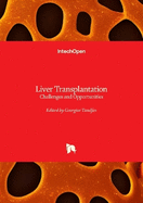 Liver Transplantation: Challenges and Opportunities