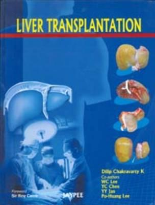 Liver Transplantation - Chakravarty, Dilip K