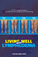 Living Well with Lymphedema: A Comprehensive Guide to Managing and Thriving