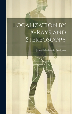 Localization by X-Rays and Stereoscopy - Davidson, James MacKenzie