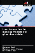 Loop traumatico del menisco mediale sul ginocchio stabile