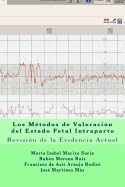 Los M?todos de Valoraci?n del Estado Fetal Intraparto: Revisi?n de la Evidencia Actual