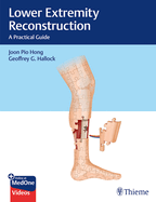 Lower Extremity Reconstruction: A Practical Guide