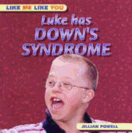 Luke Has Down's Syndrome