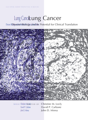 Lung Cancer: Disease Biology and Its Potential for Clinical Translation - Lovly, Christine M (Editor), and Carbone, David P (Editor), and Minna, John D (Editor)