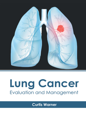 Lung Cancer: Evaluation and Management - Warner, Curtis (Editor)