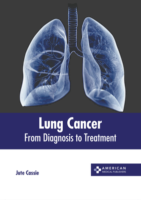 Lung Cancer: From Diagnosis to Treatment - Cassie, Jute (Editor)