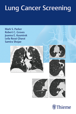 Lung Cancer Screening - Parker, Mark, and Groves, Robert, and Kusmirek, Joanna