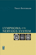 Lymphoma of the Nervous System