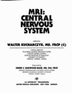 M.R.I. Central Nervous System
