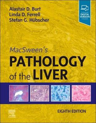 Macsween's Pathology of the Liver - Burt, Alastair D, MD, and Ferrell, Linda D, MD, and Hbscher, Stefan G