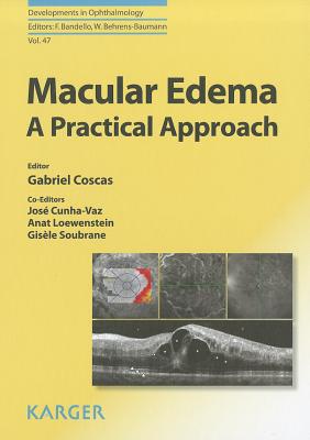 Macular Edema: A Practical Approach - Coscas, G. (Editor), and Cunha-Vaz, J. (Editor), and Loewenstein, A. (Editor)