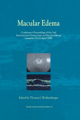 Macular Edema: Conference Proceedings of the 2nd International Symposium on Macular Edema, Lausanne, 23-25 April 1998 - Wolfensberger, Thomas J (Editor)