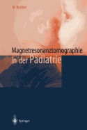 Magnetresonanztomographie in Der Pdiatrie