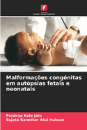 Malforma??es cong?nitas em aut?psias fetais e neonatais