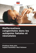 Malformations cong?nitales dans les autopsies foetales et n?onatales