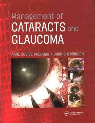 Management of Cataracts and Glaucoma - Coleman, Anne Louise (Editor), and Morrison, John C (Editor)