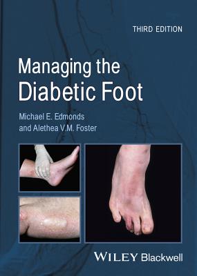 Managing the Diabetic Foot - Edmonds, Michael E., and Foster, Alethea V. M.