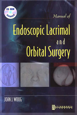 Manual of Endoscopic Lacrimal and Orbital Surgery - Woog, John J, MD, Facs