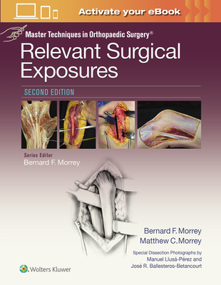 Master Techniques in Orthopaedic Surgery: Relevant Surgical Exposures - Morrey, Bernard F., MD