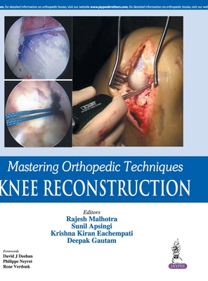 Mastering Orthopedic Techniques: Knee Reconstruction - Malhotra, Rajesh, and Apsingi, Sunil, and Eachempati, Krishna Kiran