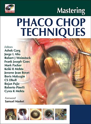 Mastering Phaco Chop Techniques - Garg, Ashok