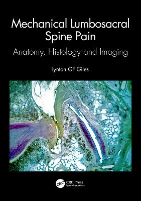 Mechanical Lumbosacral Spine Pain: Anatomy, Histology and Imaging - Giles, Lynton Gf