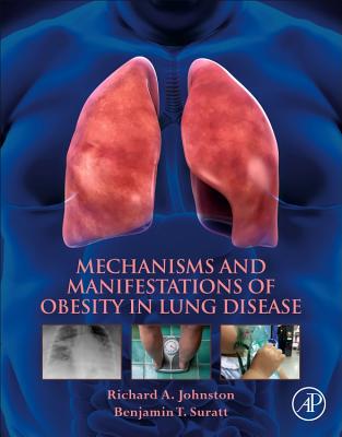 Mechanisms and Manifestations of Obesity in Lung Disease - Johnston, Richard A, and Suratt, Benjamin T