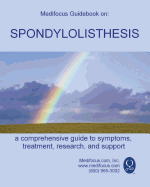 Medifocus Guidebook on: Spondylolisthesis