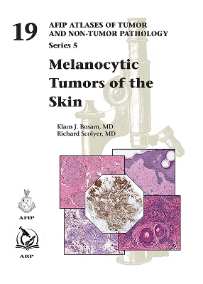 Melanocytic Tumors of Skin - Busam, Klaus J., and Scolyer, Richard, and Taylor, Kara