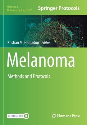 Melanoma: Methods and Protocols - Hargadon, Kristian M. (Editor)