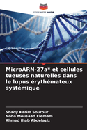 MicroARN-27a* et cellules tueuses naturelles dans le lupus ?ryth?mateux syst?mique