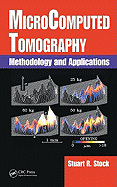 Microcomputed Tomography: Methodology and Applications